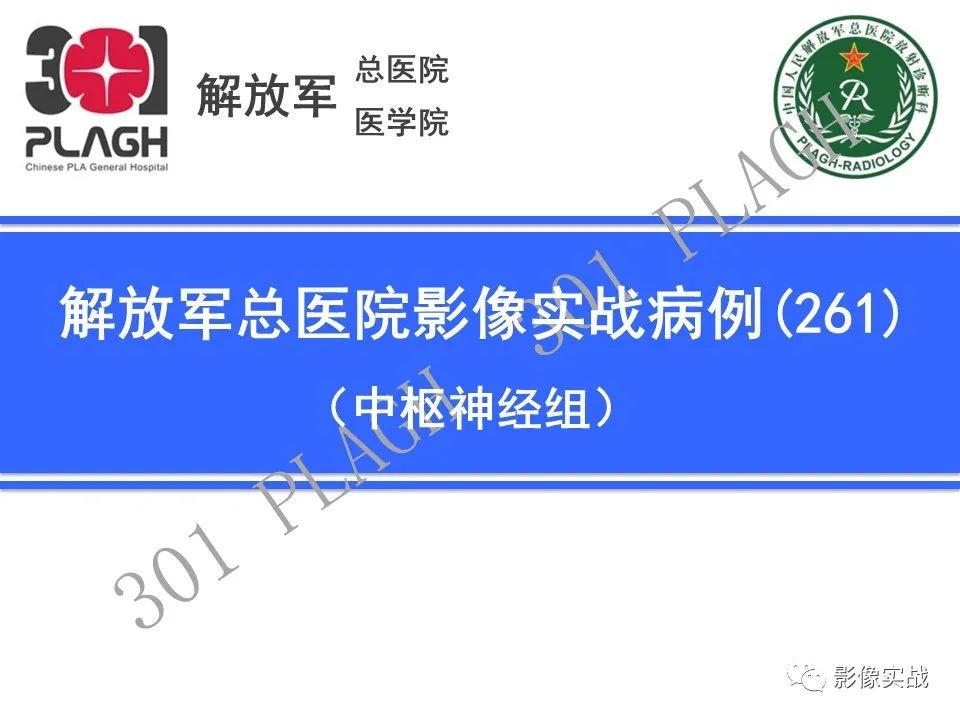 影像PPT - 【病例】桥小脑角区神经鞘瘤1例CT及MR影像-1