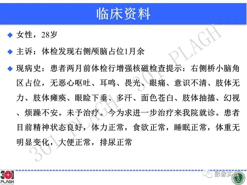 影像PPT - 【病例】桥小脑角区神经鞘瘤1例CT及MR影像-2