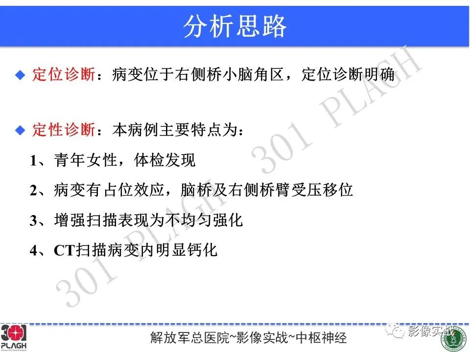 影像PPT - 【病例】桥小脑角区神经鞘瘤1例CT及MR影像-16