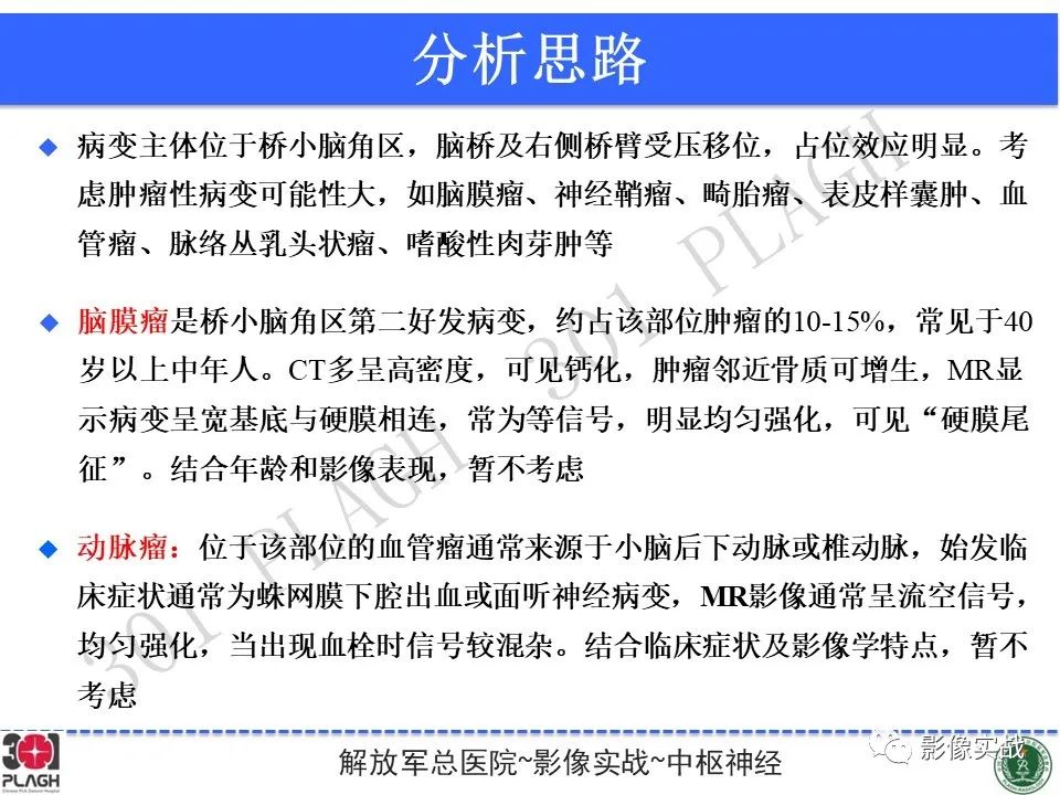 影像PPT - 【病例】桥小脑角区神经鞘瘤1例CT及MR影像-17