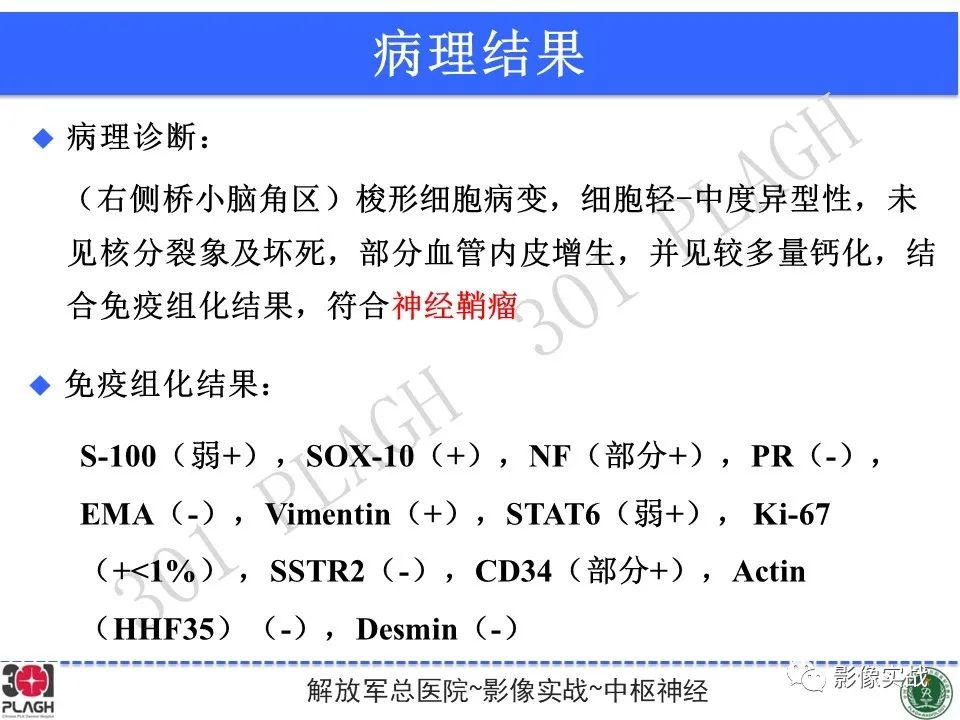 影像PPT - 【病例】桥小脑角区神经鞘瘤1例CT及MR影像-21