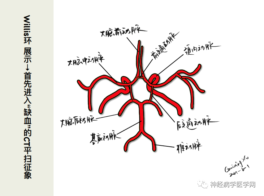影像PPT - 【PPT】特征性异常脑影像荟萃(手绘重置版)-5