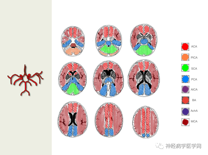 影像PPT - 【PPT】特征性异常脑影像荟萃(手绘重置版)-6