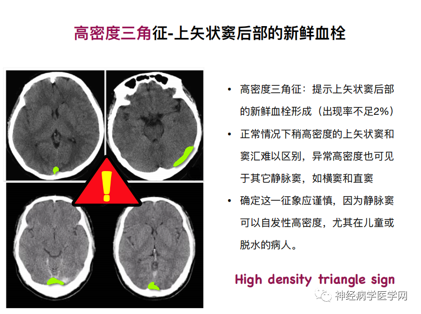 影像PPT - 【PPT】特征性异常脑影像荟萃(手绘重置版)-16