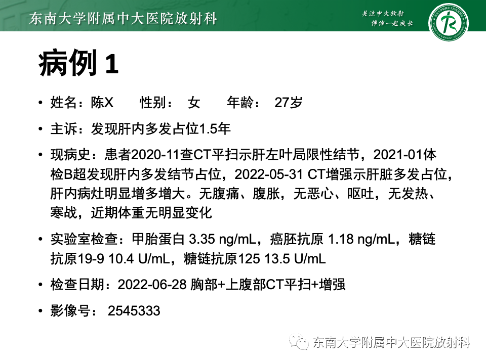 影像PPT - 【PPT】肝脏上皮样血管内皮瘤-2 影像PPT - 【PPT】肝脏上皮样血管内皮瘤-2