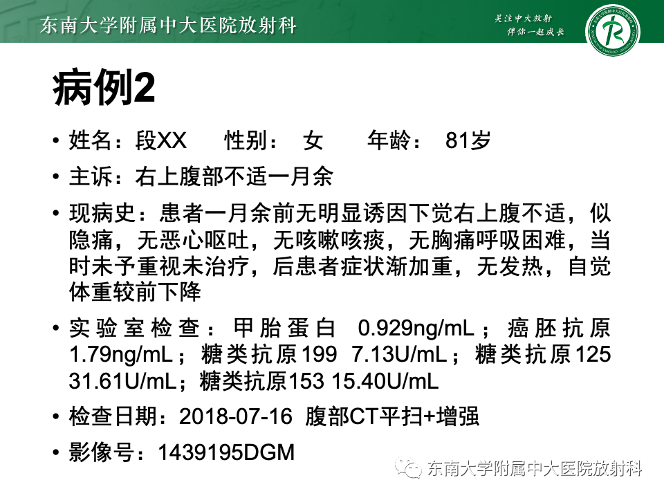 影像PPT - 【PPT】肝脏上皮样血管内皮瘤-17 影像PPT - 【PPT】肝脏上皮样血管内皮瘤-17