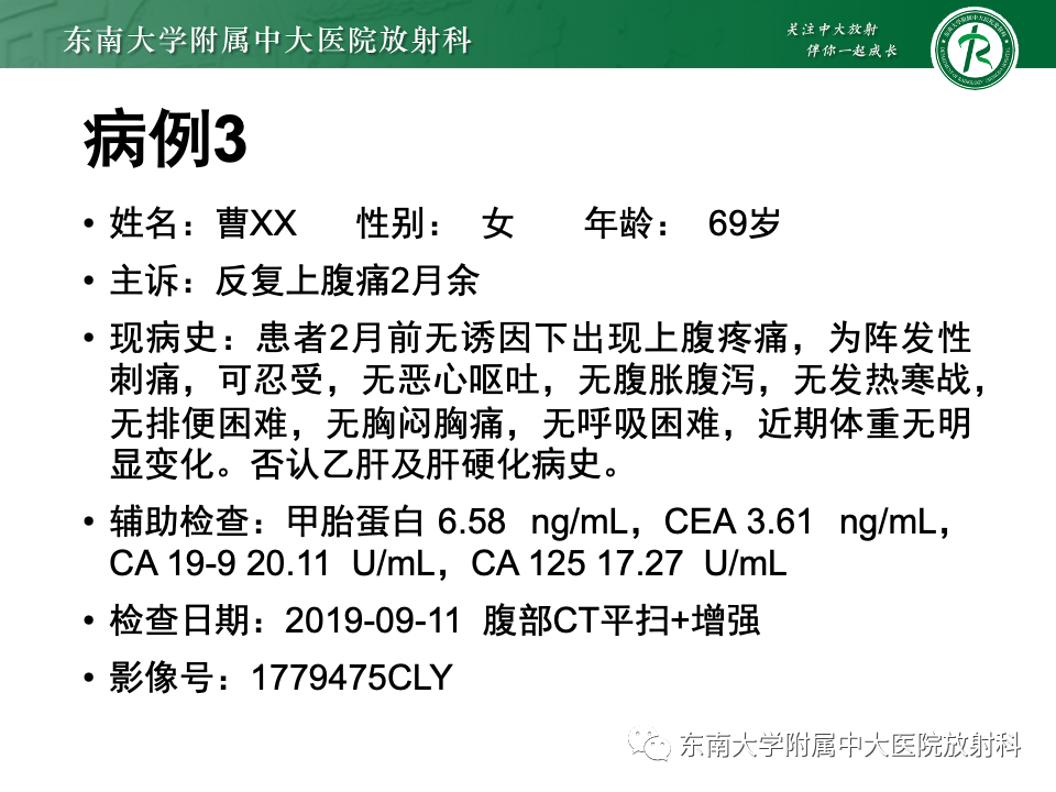 影像PPT - 【PPT】肝脏上皮样血管内皮瘤-24 影像PPT - 【PPT】肝脏上皮样血管内皮瘤-24