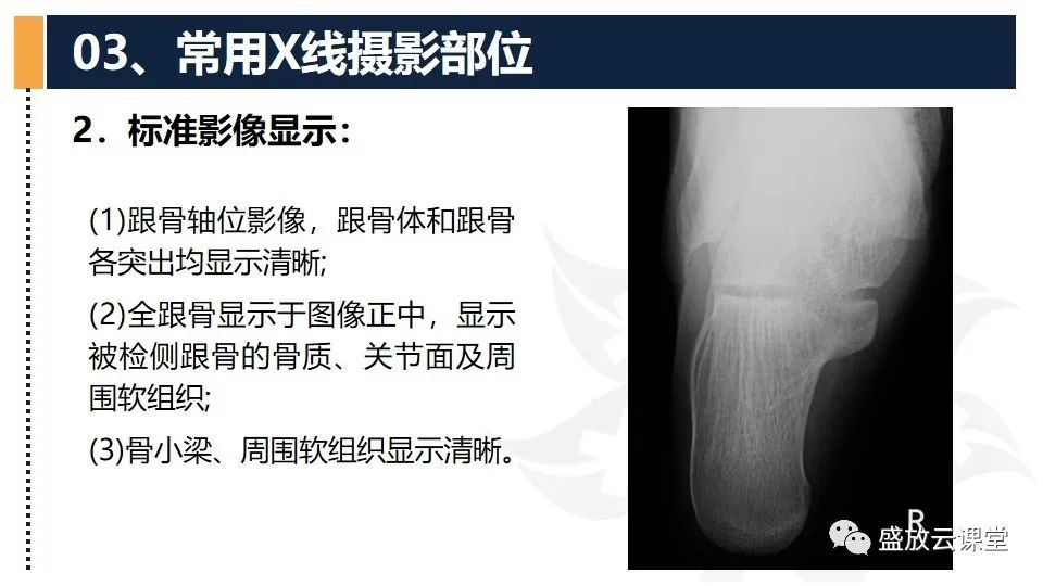 影像PPT - 【PPT】数字X线摄影检查（四）-4