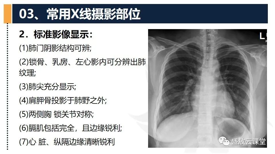 影像PPT - 【PPT】数字X线摄影检查（四）-6