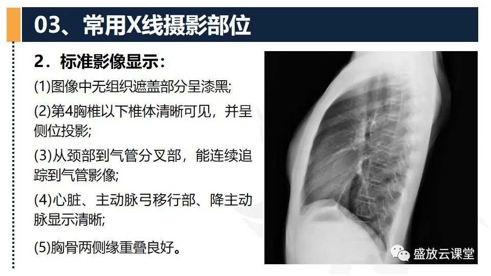 影像PPT - 【PPT】数字X线摄影检查（四）-8