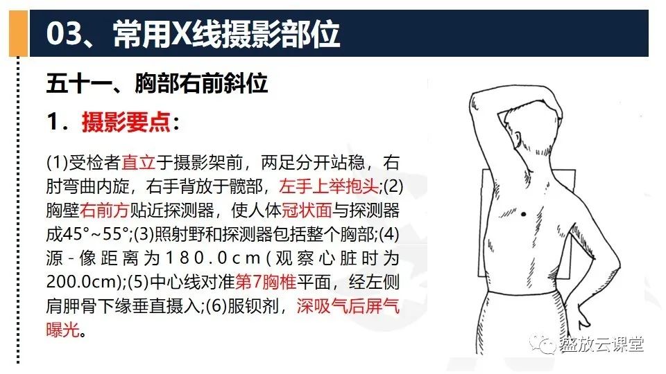 影像PPT - 【PPT】数字X线摄影检查（四）-9