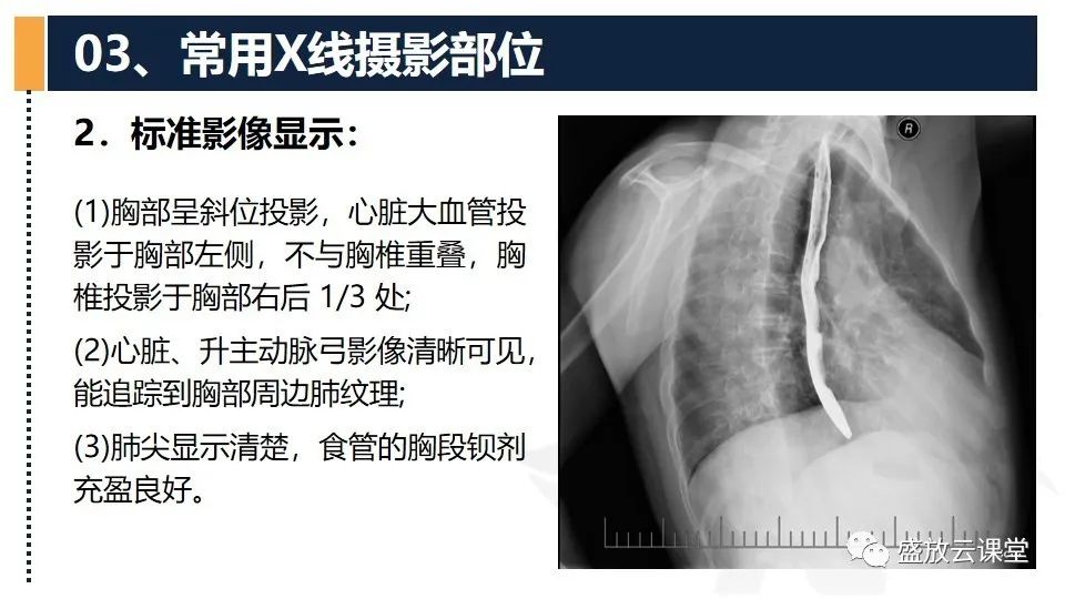 影像PPT - 【PPT】数字X线摄影检查（四）-10