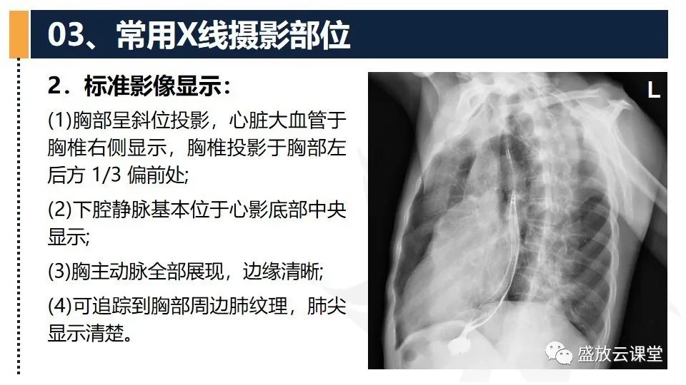 影像PPT - 【PPT】数字X线摄影检查（四）-12