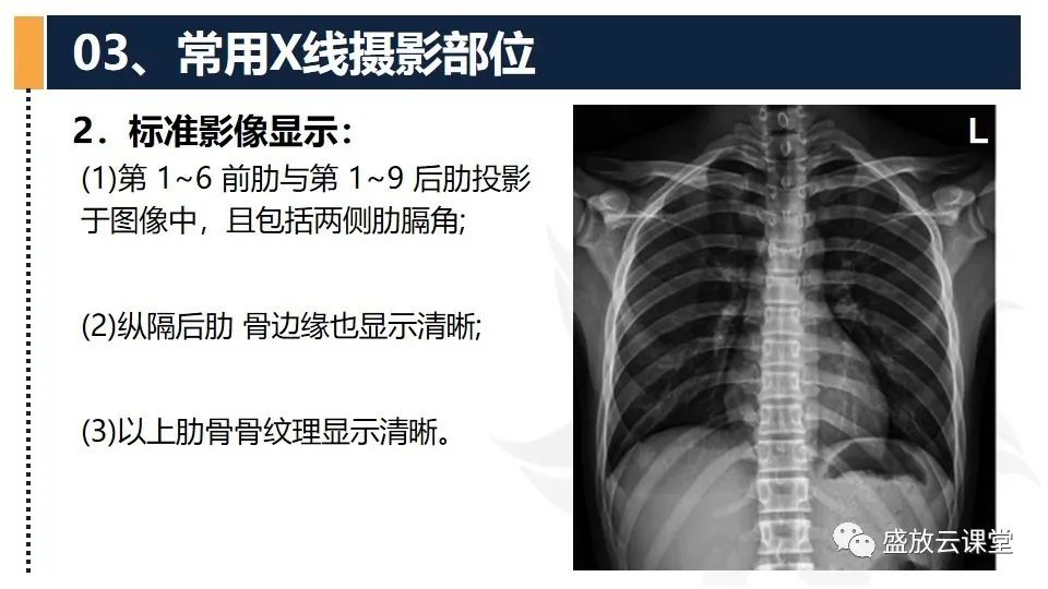 影像PPT - 【PPT】数字X线摄影检查（四）-14