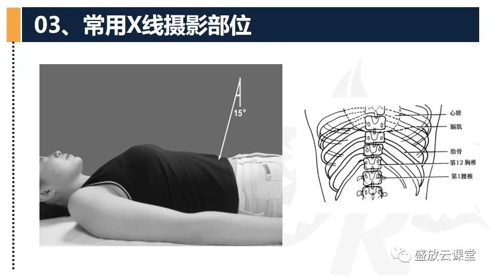 影像PPT - 【PPT】数字X线摄影检查（四）-16