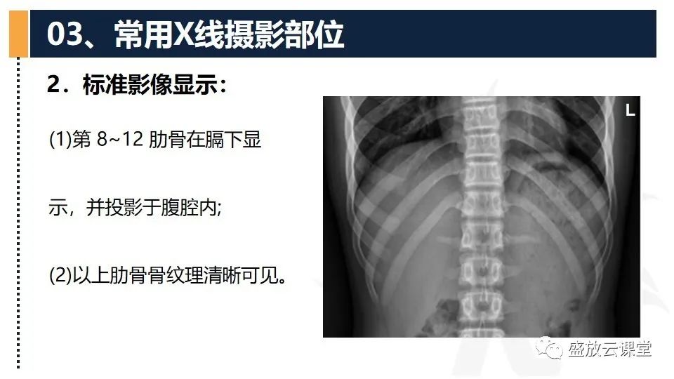 影像PPT - 【PPT】数字X线摄影检查（四）-17