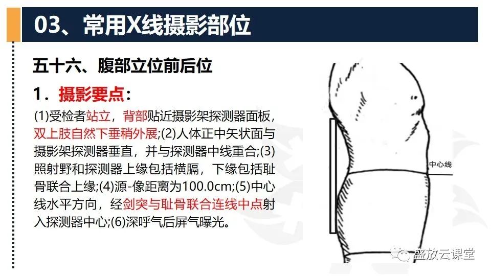 影像PPT - 【PPT】数字X线摄影检查（四）-20