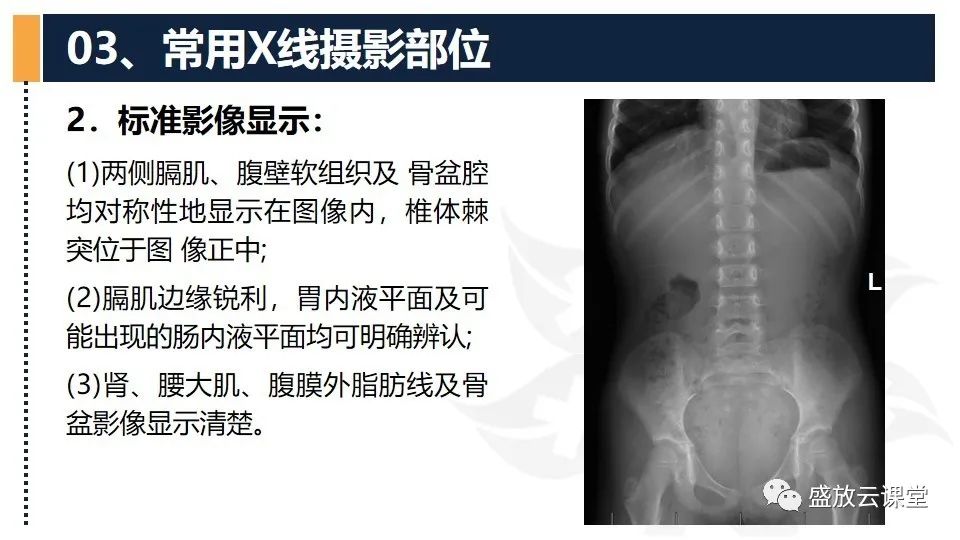 影像PPT - 【PPT】数字X线摄影检查（四）-21