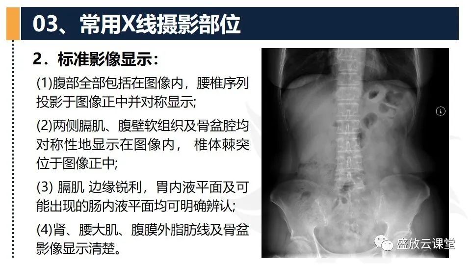 影像PPT - 【PPT】数字X线摄影检查（四）-19