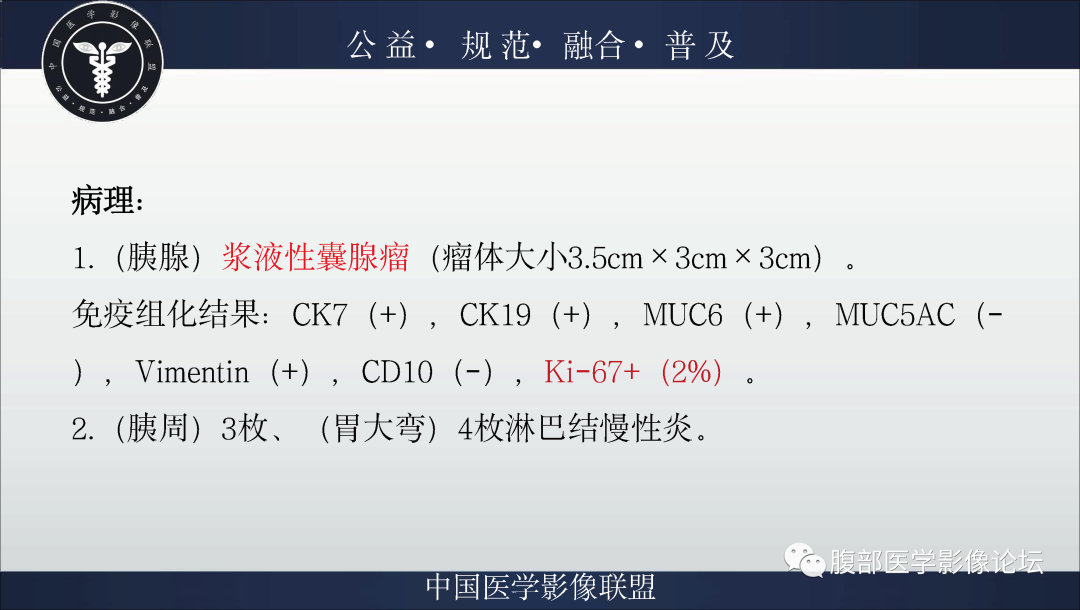 影像PPT - 【病例】胰腺浆液性囊腺瘤1例影像表现-12