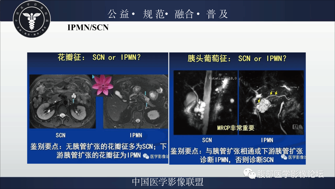 影像PPT - 【病例】胰腺浆液性囊腺瘤1例影像表现-36