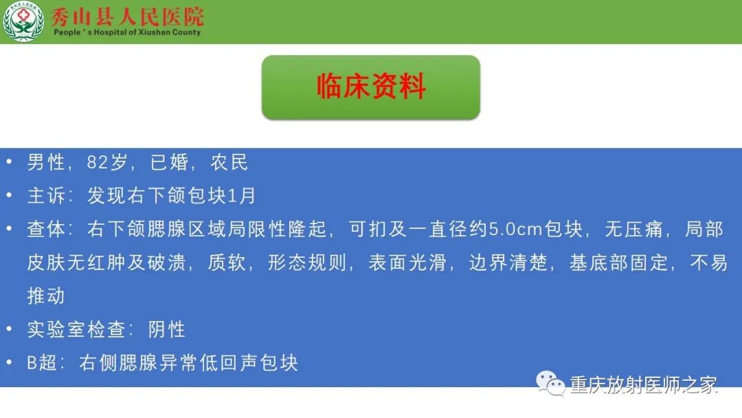 影像PPT - 【病例】腮腺基底细胞腺瘤1例CT影像-2