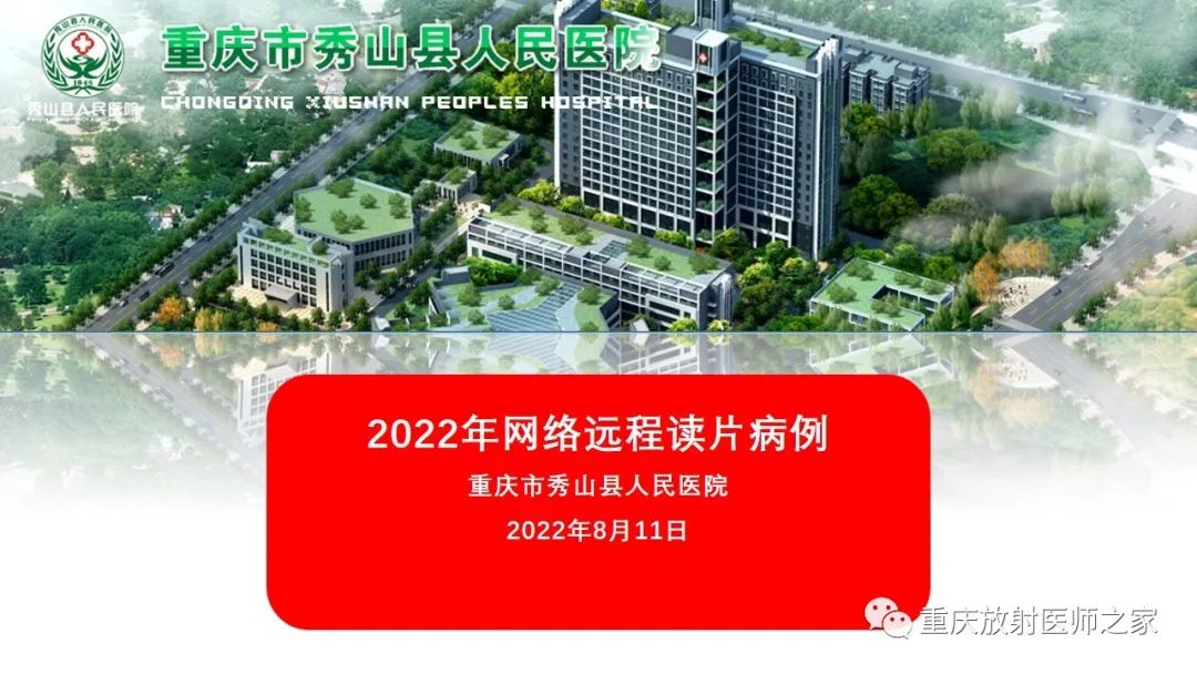 影像PPT - 【病例】腮腺基底细胞腺瘤1例CT影像-1