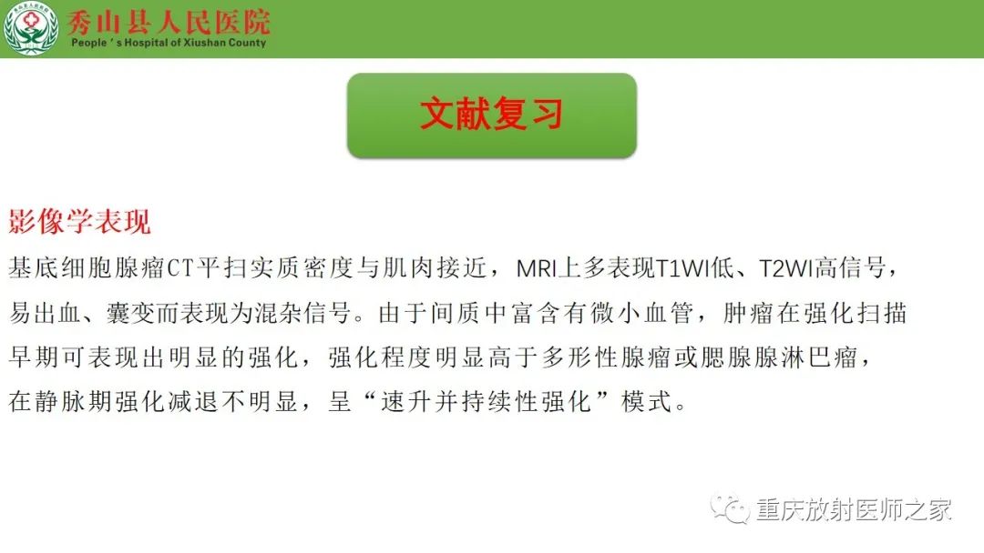 影像PPT - 【病例】腮腺基底细胞腺瘤1例CT影像-15