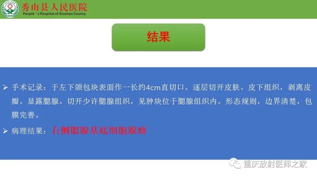 影像PPT - 【病例】腮腺基底细胞腺瘤1例CT影像-12