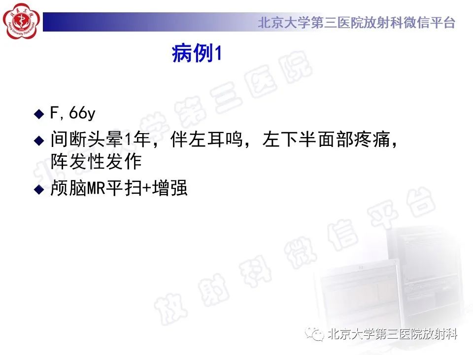 影像PPT - 【PPT】桥小脑角区肿瘤-2