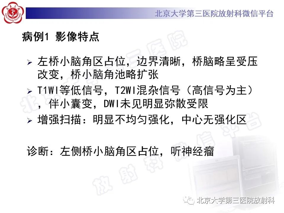 影像PPT - 【PPT】桥小脑角区肿瘤-5