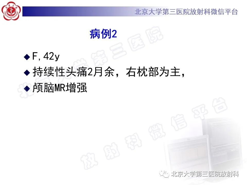 影像PPT - 【PPT】桥小脑角区肿瘤-6