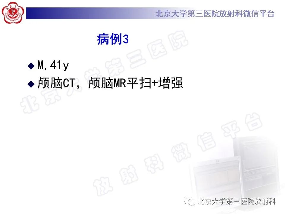 影像PPT - 【PPT】桥小脑角区肿瘤-9