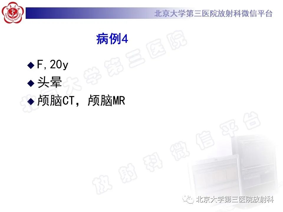 影像PPT - 【PPT】桥小脑角区肿瘤-12