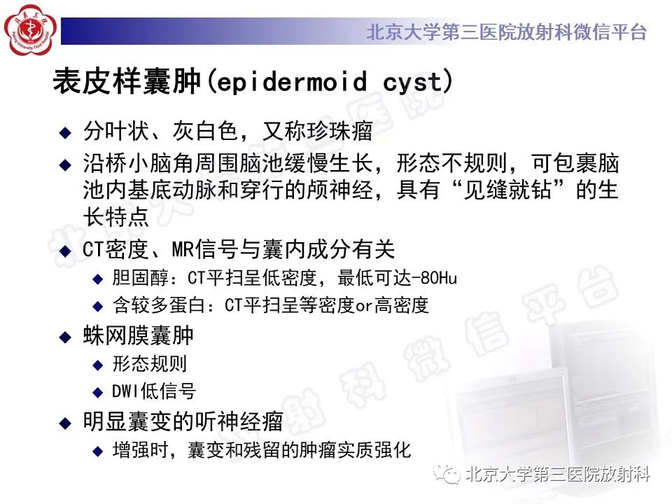 影像PPT - 【PPT】桥小脑角区肿瘤-21