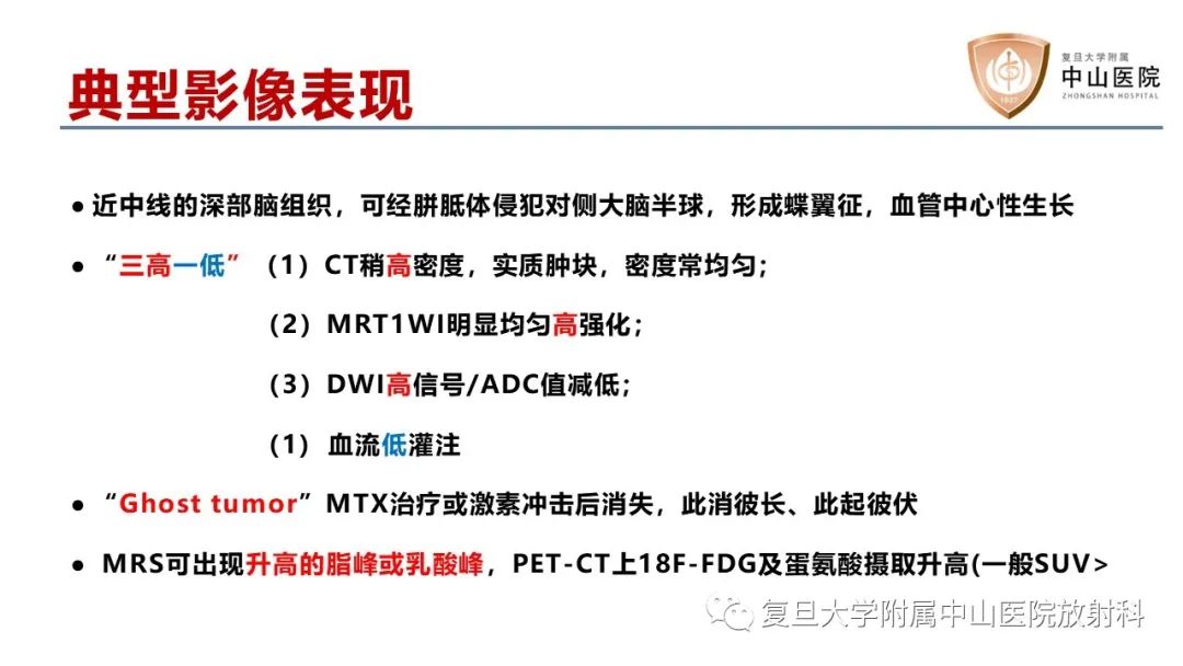 影像PPT - 【病例】原发性中枢神经系统淋巴瘤1例MR影像-11