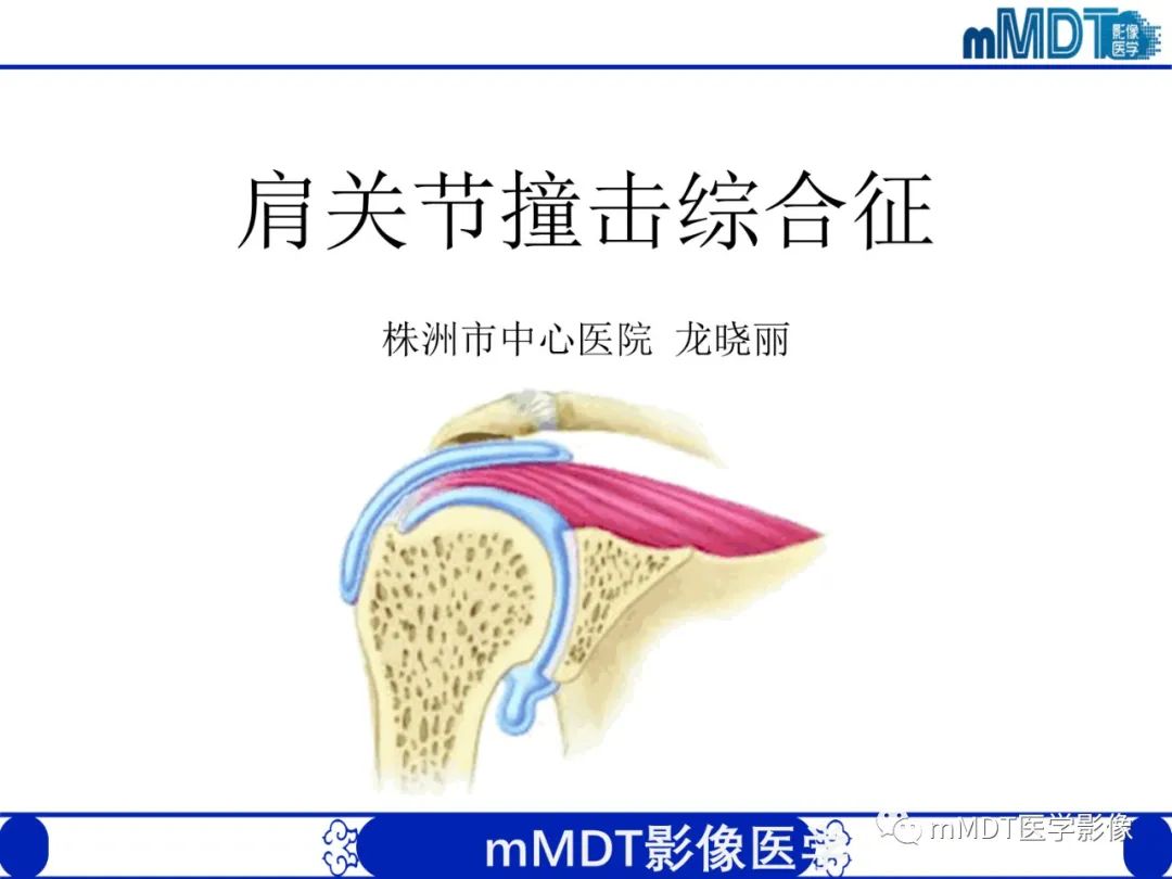 影像PPT - 【PPT】肩关节撞击综合征-7