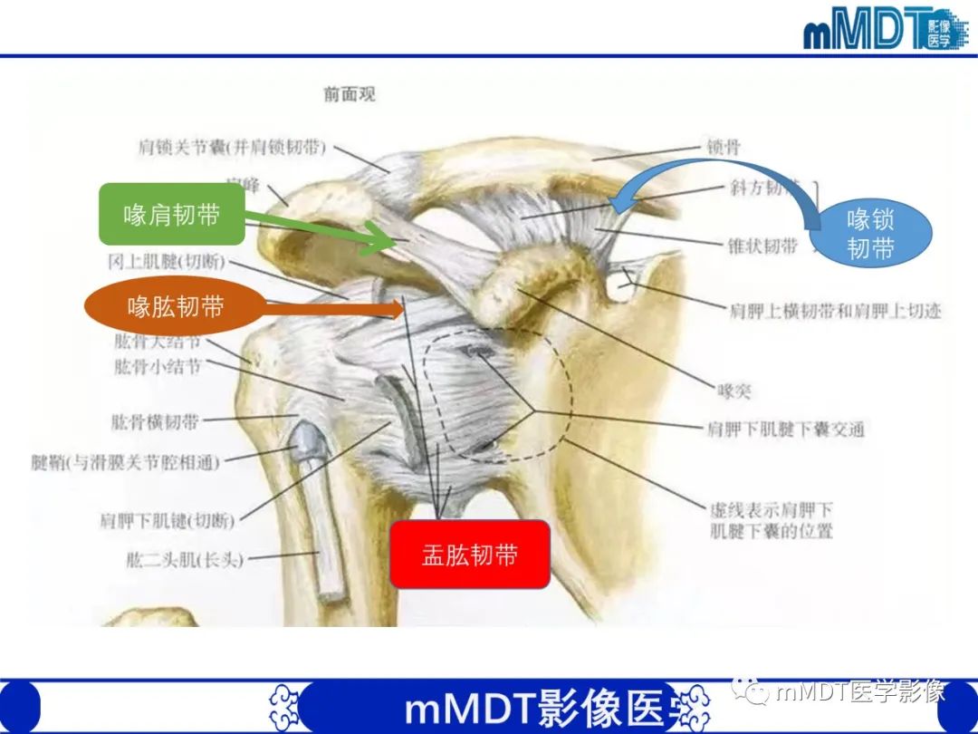 影像PPT - 【PPT】肩关节撞击综合征-13