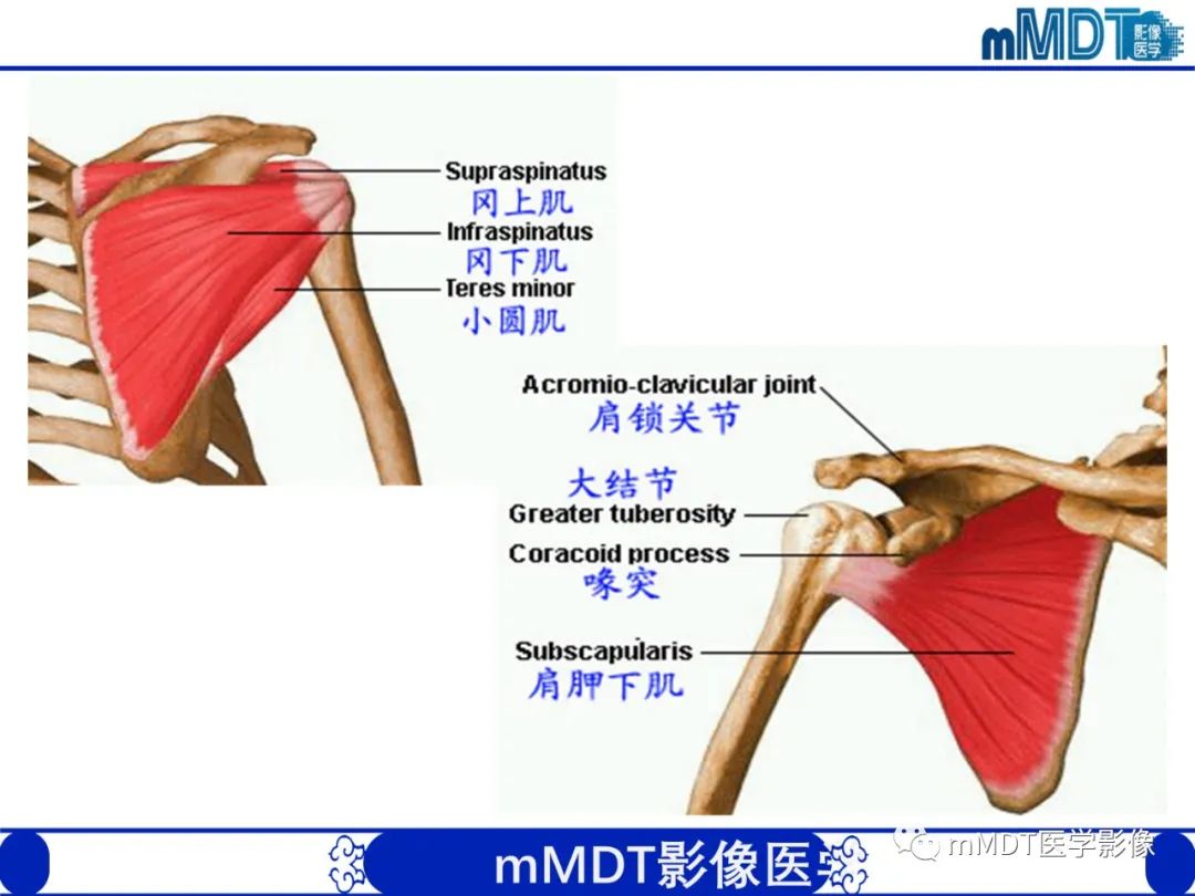 影像PPT - 【PPT】肩关节撞击综合征-19