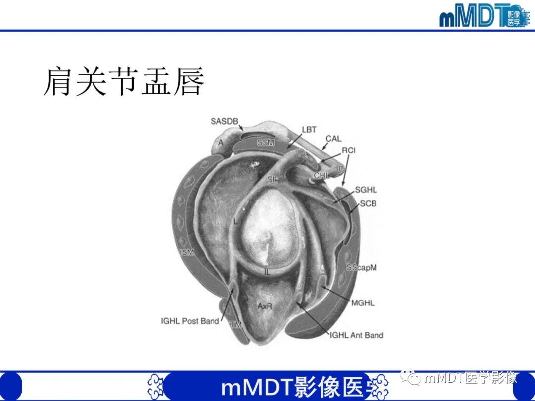 影像PPT - 【PPT】肩关节撞击综合征-39
