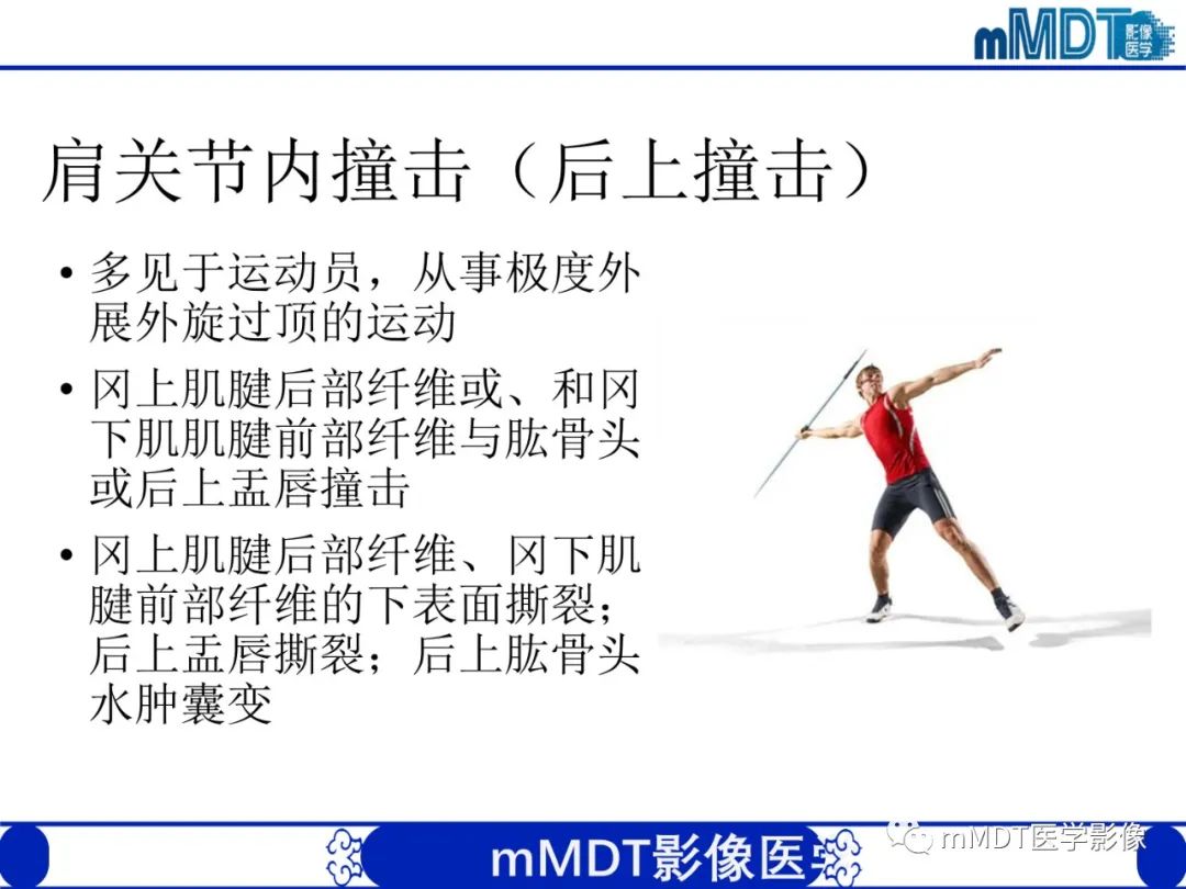 影像PPT - 【PPT】肩关节撞击综合征-67