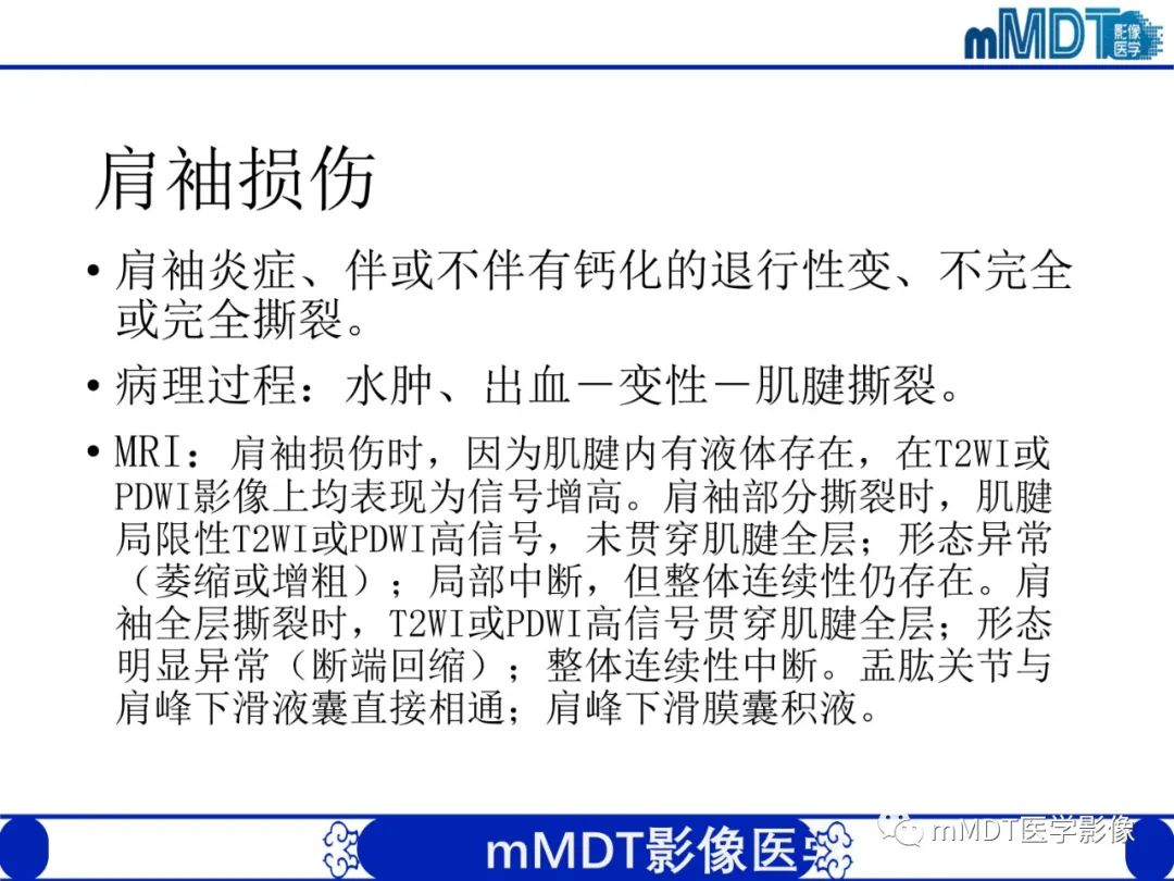 影像PPT - 【PPT】肩关节撞击综合征-74