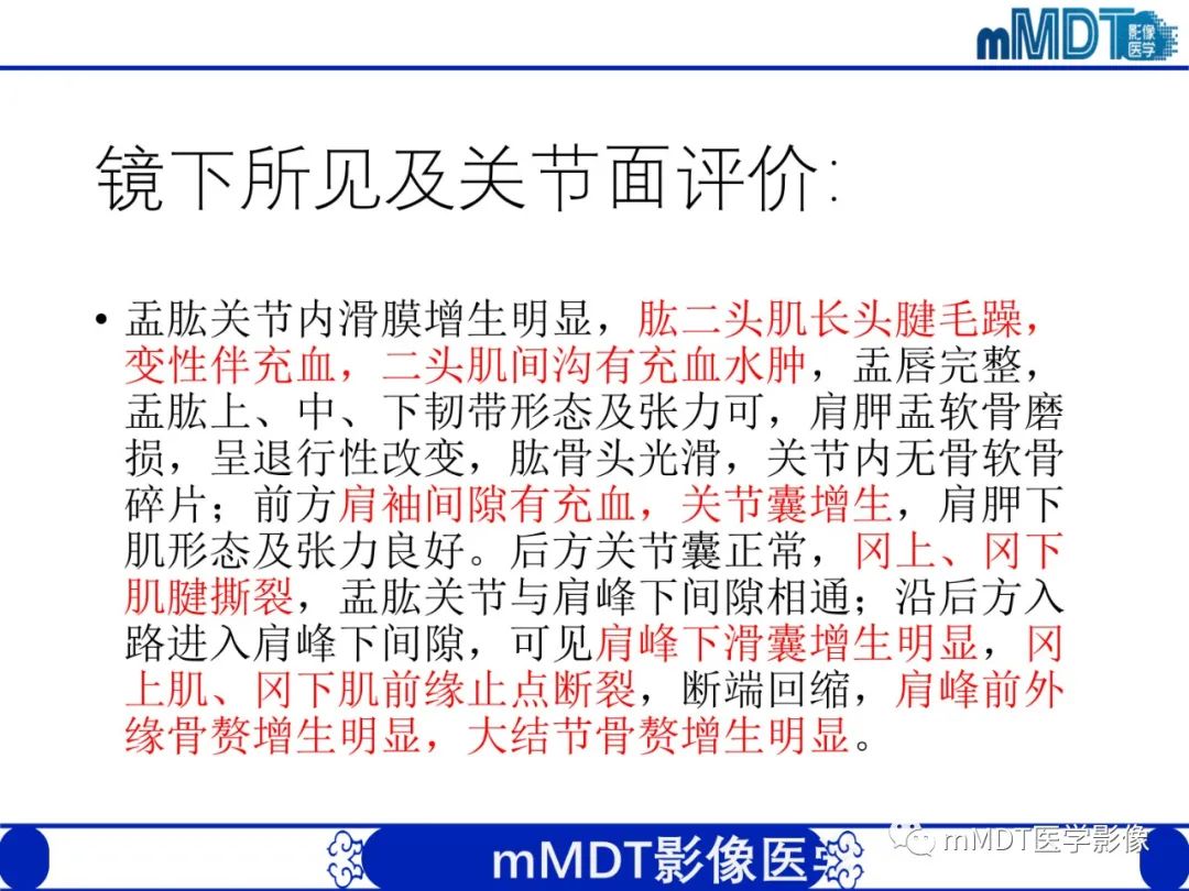 影像PPT - 【PPT】肩关节撞击综合征-82