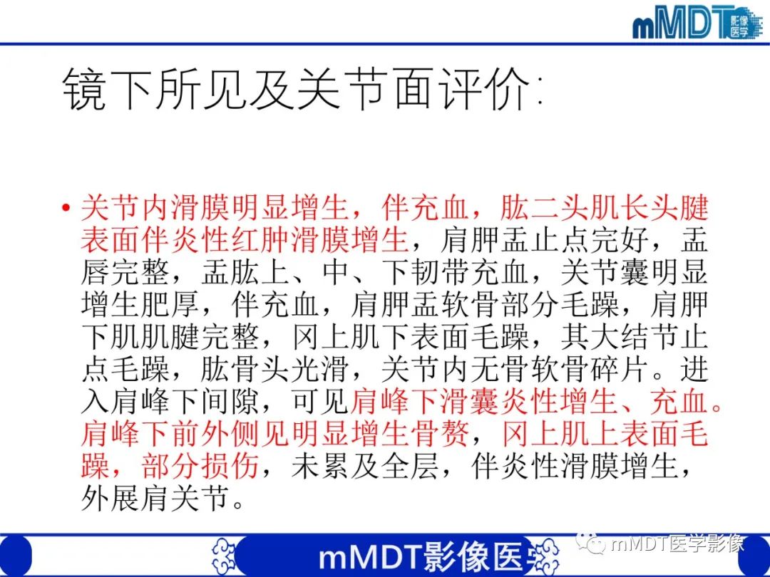 影像PPT - 【PPT】肩关节撞击综合征-90