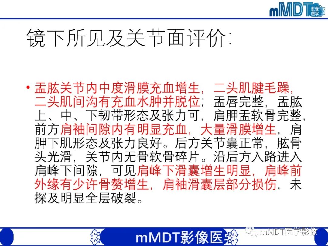 影像PPT - 【PPT】肩关节撞击综合征-98