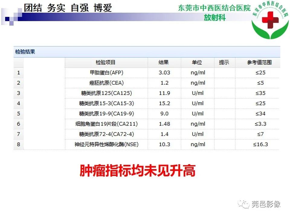 影像PPT - 【PPT】颅内孤立性纤维性肿瘤的影像诊断-3