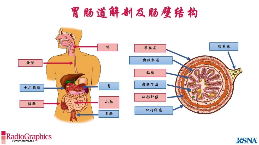 影像PPT - 【PPT】胃肠道扩张:为什么会发生以及如何发生的病理生理机制？——简易的影像学分类-15