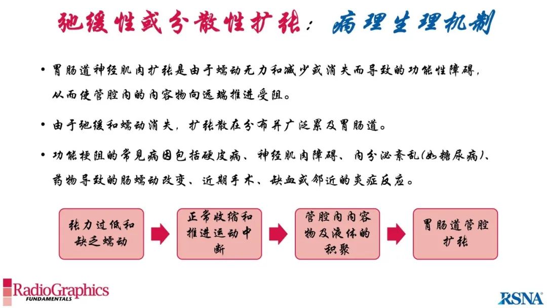 影像PPT - 【PPT】胃肠道扩张:为什么会发生以及如何发生的病理生理机制？——简易的影像学分类-21