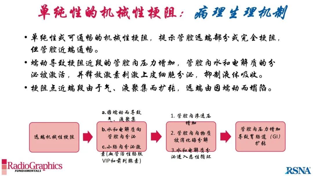 影像PPT - 【PPT】胃肠道扩张:为什么会发生以及如何发生的病理生理机制？——简易的影像学分类-35