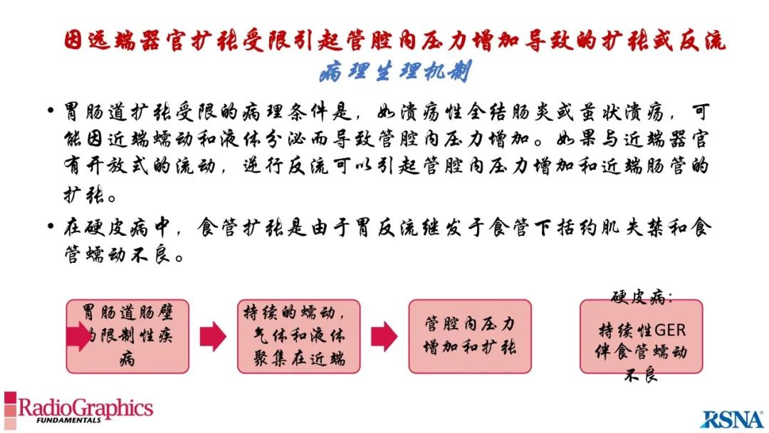 影像PPT - 【PPT】胃肠道扩张:为什么会发生以及如何发生的病理生理机制？——简易的影像学分类-79